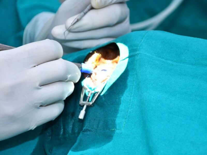 cataract surgeon in varanasi up