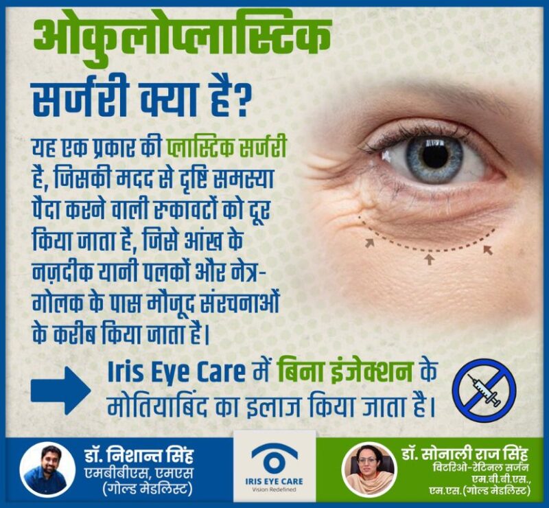 Oculoplastic surgery in Varanasi - Dr Nishant Singh Iris Eye Care